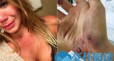 名模女星遭家暴 名模女星是谁
