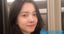 庄达菲是单亲吗 酒窝美女庄达菲下颌骨关节错位怎么回事