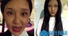 桃花宝宝是男的女的 桃花宝宝没整容之前的真面目是怎样的