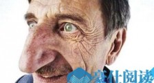 世界上鼻子最大的人 最长的应该是14厘米世界纪录是8.8
