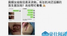 范丞丞洗澡摔倒怎么回事 揭具体详情范丞丞受伤照流出