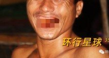 缅甸男人,为什么满嘴流血
