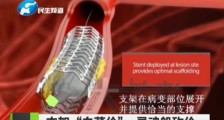 医药集采再出重拳,能砸烂多少人层层盘剥的金饭碗?