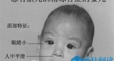 人工智能看脸识病真的吗 人工智能识病的优缺点是什么