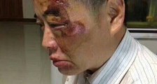 昆山“反杀”案持续发酵 网上这些言论均为假别信