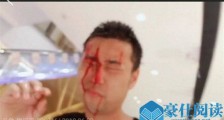钱小佳被爆头视频曝光 钱小佳被打事件始末起底掀热议