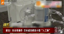 日本研发人工肺 什么是人工肺?有什么作用?