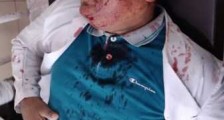 印度医生被当瘟神 具体是什么情况?发生了什么事?